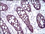 CDH17 Antibody in Immunohistochemistry (Paraffin) (IHC (P))