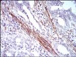 Calponin 1 Antibody in Immunohistochemistry (Paraffin) (IHC (P))