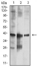Calponin 3 Antibody in Western Blot (WB)
