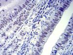 CTNNBL1 Antibody in Immunohistochemistry (Paraffin) (IHC (P))