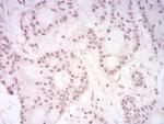 UAP56 Antibody in Immunocytochemistry (ICC/IF)