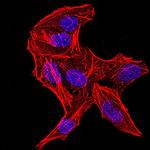 DDX3 Antibody in Immunocytochemistry (ICC/IF)