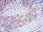 DDX3 Antibody in Immunohistochemistry (Paraffin) (IHC (P))