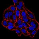 DNMT3B Antibody in Immunocytochemistry (ICC/IF)