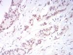 DNMT3B Antibody in Immunohistochemistry (Paraffin) (IHC (P))