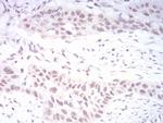 DNMT3B Antibody in Immunohistochemistry (Paraffin) (IHC (P))