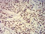 EHMT2 Antibody in Immunohistochemistry (Paraffin) (IHC (P))