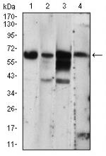 PKR Antibody in Western Blot (WB)