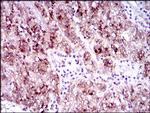 FLT3 Antibody in Immunohistochemistry (Paraffin) (IHC (P))