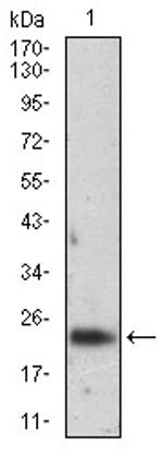 Ferritin Light Chain Antibody in Western Blot (WB)