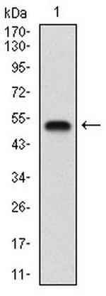 GABBR2 Antibody in Western Blot (WB)