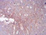 GLI1 Antibody in Immunohistochemistry (Paraffin) (IHC (P))