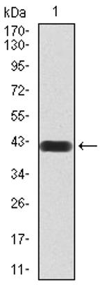 HDAC4 Antibody in Western Blot (WB)