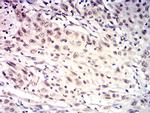 HTRA2 Antibody in Immunohistochemistry (Paraffin) (IHC (P))