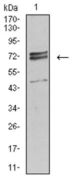 IL1R1 Antibody in Western Blot (WB)