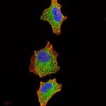 IRAK-M Antibody in Immunocytochemistry (ICC/IF)