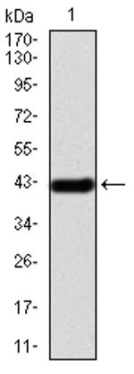 IRAK-M Antibody in Western Blot (WB)