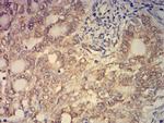 PCAF Antibody in Immunohistochemistry (Paraffin) (IHC (P))