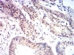 MYST2 Antibody in Immunohistochemistry (Paraffin) (IHC (P))