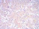 LDLR Antibody in Immunohistochemistry (Paraffin) (IHC (P))