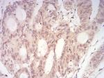 MEK3 Antibody in Immunohistochemistry (Paraffin) (IHC (P))