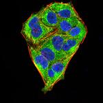 MECP2 Antibody in Immunocytochemistry (ICC/IF)