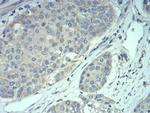 MECP2 Antibody in Immunohistochemistry (Paraffin) (IHC (P))