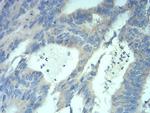 MECP2 Antibody in Immunohistochemistry (Paraffin) (IHC (P))