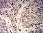 MYLK Antibody in Immunohistochemistry (Paraffin) (IHC (P))