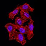 hnRNP M Antibody in Immunocytochemistry (ICC/IF)