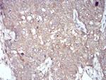 NOX4 Antibody in Immunohistochemistry (Paraffin) (IHC (P))