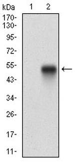 PDGFRA Antibody in Western Blot (WB)