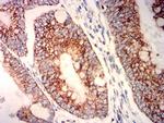 PLA2G7 Antibody in Immunohistochemistry (Paraffin) (IHC (P))