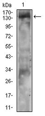 PLCG2 Antibody in Western Blot (WB)