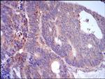 ADFP Antibody in Immunohistochemistry (Paraffin) (IHC (P))