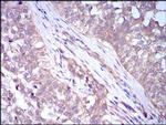 ADFP Antibody in Immunohistochemistry (Paraffin) (IHC (P))