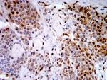 PSMC3 Antibody in Immunohistochemistry (Paraffin) (IHC (P))