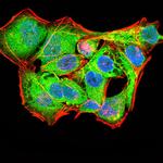 PYCARD Antibody in Immunocytochemistry (ICC/IF)