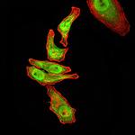 RAN Antibody in Immunocytochemistry (ICC/IF)