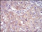 RSK3 Antibody in Immunohistochemistry (Paraffin) (IHC (P))