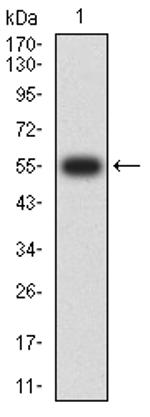 SETD7 Antibody in Western Blot (WB)