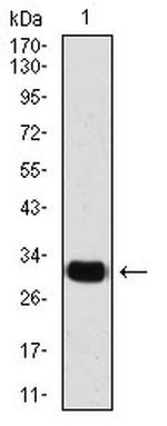 SLUG Antibody in Western Blot (WB)