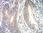 TIA-1 Antibody in Immunohistochemistry (Paraffin) (IHC (P))