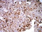 TLR9 Antibody in Immunohistochemistry (Paraffin) (IHC (P))