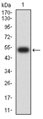 TOP2A Antibody in Western Blot (WB)