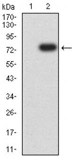 TOP2A Antibody in Western Blot (WB)