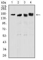 TOP2A Antibody in Western Blot (WB)