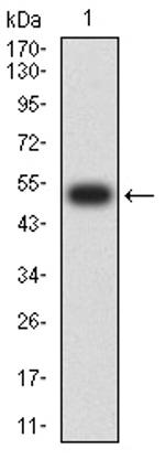 TOP2A Antibody in Western Blot (WB)