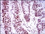 53BP1 Antibody in Immunohistochemistry (Paraffin) (IHC (P))