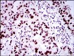 53BP1 Antibody in Immunohistochemistry (Paraffin) (IHC (P))